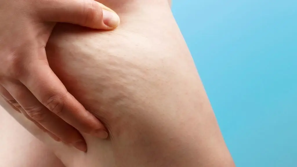Female hand holds hip, cellulite
