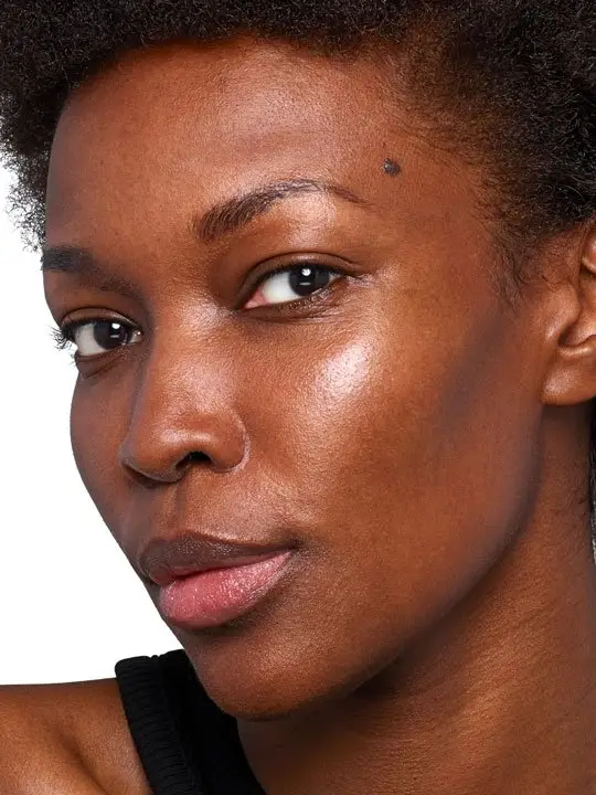 after skinvive treatment