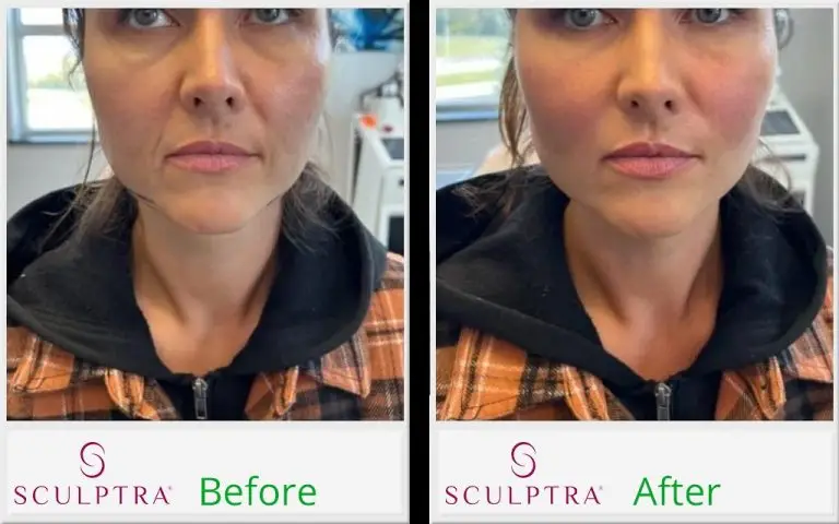sculptura before and after
