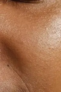 closeup of face with glowing skin